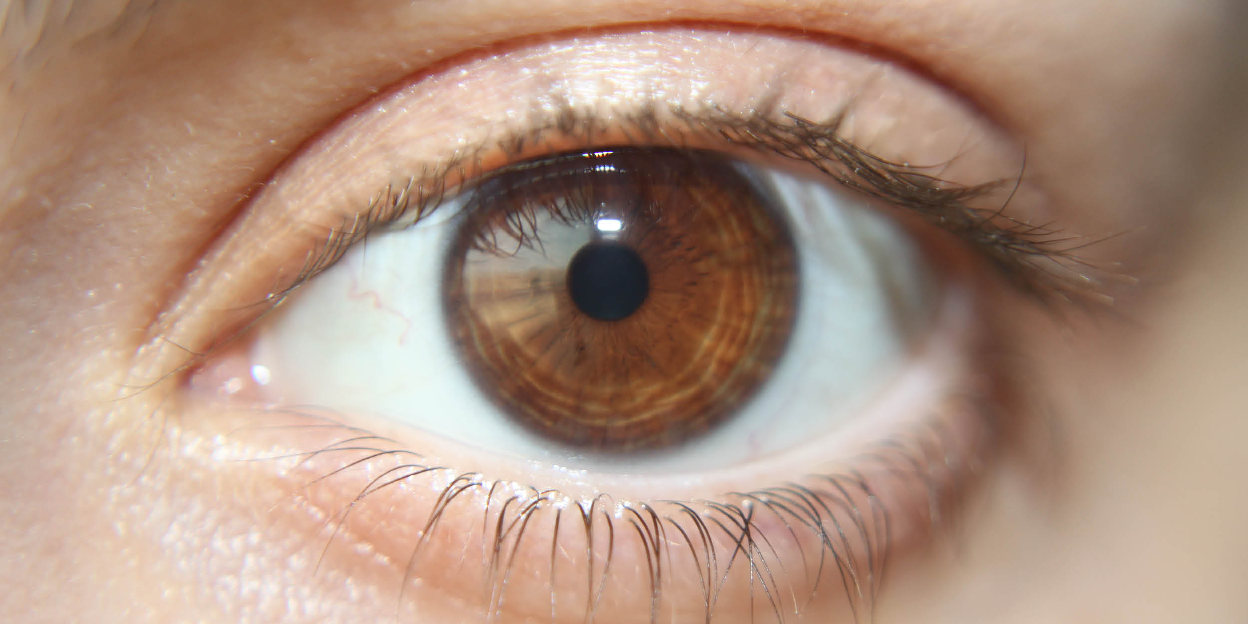 Макросъемка глаза человека с катарактой
